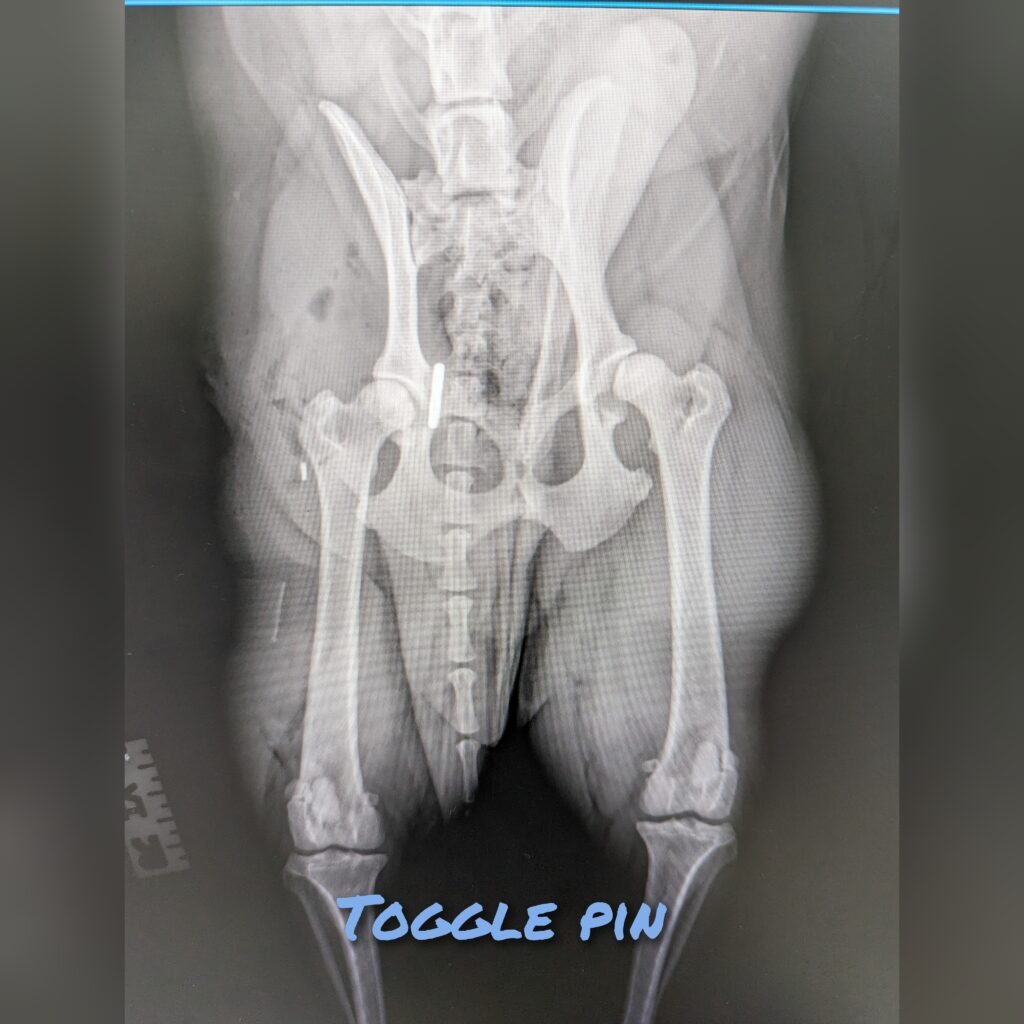 Hip Luxation – Toggle Pin technique gridart 20240215 161054079