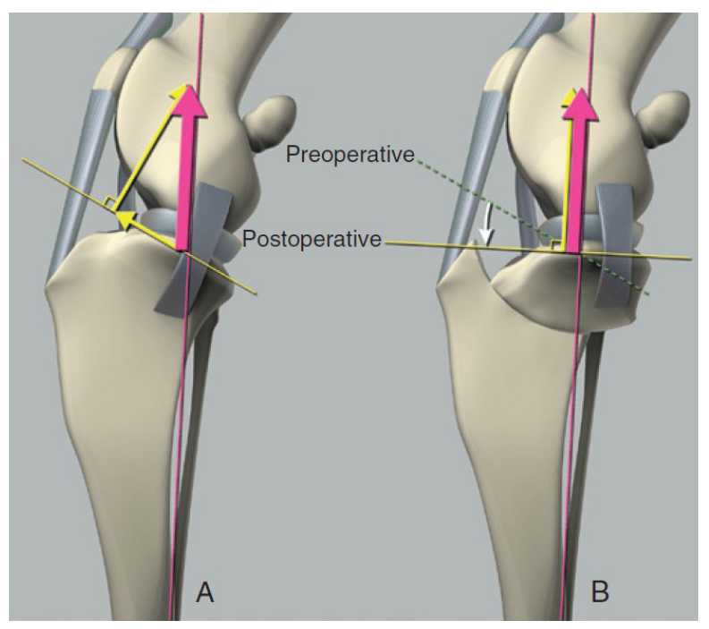 tplo diagram